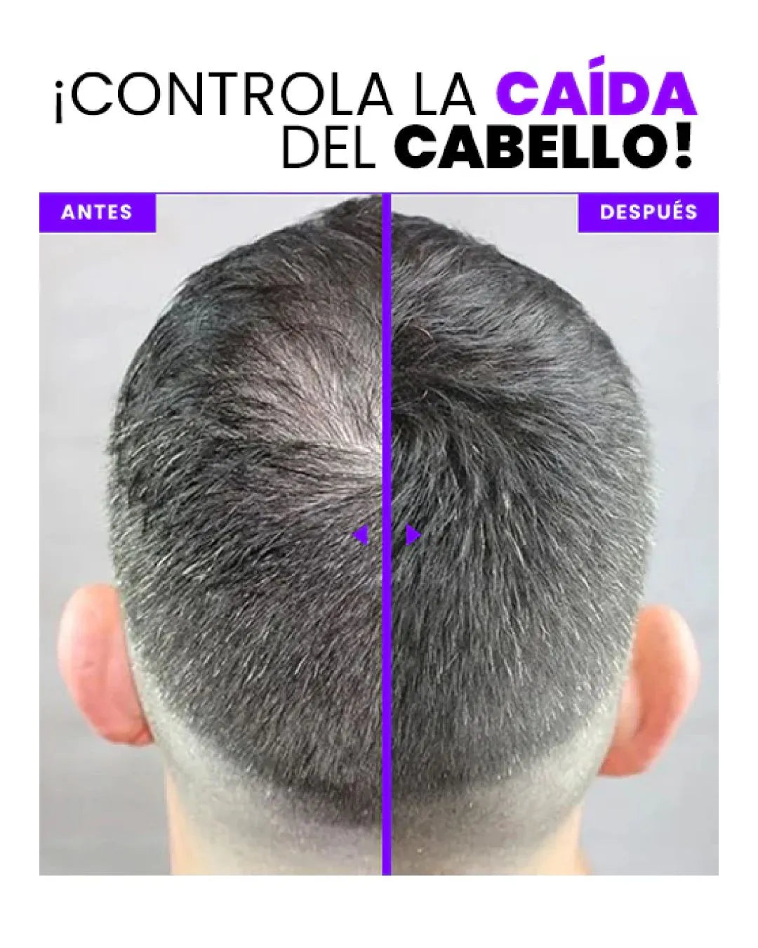 DenseLook Fibra Capilar — Recupera tu densidad en 30 segundos con acabado natural