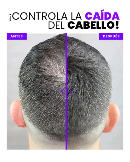 DenseLook Fibra Capilar — Recupera tu densidad en 30 segundos con acabado natural