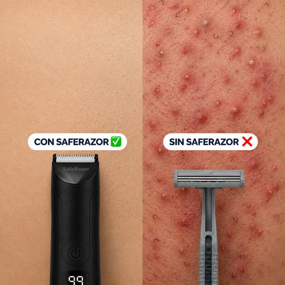 SafeRazor - Rasúrate abajo en la ducha en 3 minutos. Sin sangre. Sin desorden