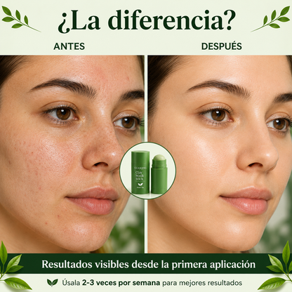 Lumiverde® - Poros Limpios, Piel Radiante